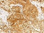 Phospho-LC3B (Thr29) Polyclonal Antibody