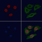 H2BK16ac Polyclonal Antibody