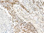 H2BK16ac Antibody in Immunohistochemistry (Paraffin) (IHC (P))