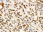 H2BK16ac Antibody in Immunohistochemistry (Paraffin) (IHC (P))