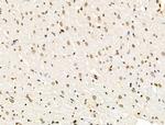 H4K91ac Antibody in Immunohistochemistry (Paraffin) (IHC (P))