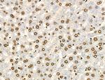 H4K91ac Antibody in Immunohistochemistry (Paraffin) (IHC (P))