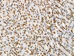 Acetyl-p53 (Lys373) Antibody in Immunohistochemistry (Paraffin) (IHC (P))