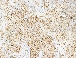 Acetyl-p53 (Lys381) Polyclonal Antibody