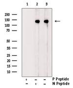 Phospho-ATP Citrate Lyase (Ser455, Ser457) Polyclonal Antibody