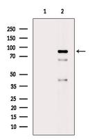 Phospho-PI3K p85 alpha (Tyr452) Polyclonal Antibody