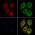 Phospho-PI3K p85 alpha (Tyr508) Polyclonal Antibody