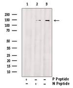 Phospho-EphA4 (Tyr596) Polyclonal Antibody