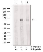 Phospho-IRAK2 (Tyr6) Polyclonal Antibody