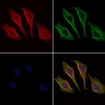 Phospho-IRAK4 (Thr342) Polyclonal Antibody