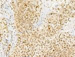 Phospho-ENSA (Ser67) Antibody in Immunohistochemistry (Paraffin) (IHC (P))