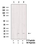 Phospho-ENSA (Ser67) Antibody in Western Blot (WB)