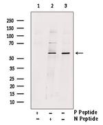 Phospho-DOK2 (Tyr345) Polyclonal Antibody