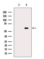Phospho-PFKFB2 (Ser483) Polyclonal Antibody
