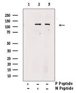 Phospho-ULK1 (Ser638) Polyclonal Antibody