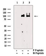 Phospho-CSF1R (Tyr923) Antibody in Western Blot (WB)