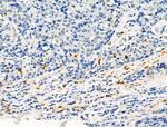 Phospho-c-Kit (Tyr721) Antibody in Immunohistochemistry (Paraffin) (IHC (P))