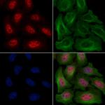 Phospho-SRC (Ser17) Polyclonal Antibody