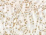 Phospho-SRC (Ser17) Antibody in Immunohistochemistry (Paraffin) (IHC (P))