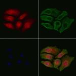 Phospho-Ku70 (Ser520) Polyclonal Antibody