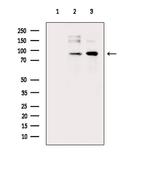 Phospho-Aconitase 1 (Ser138) Polyclonal Antibody