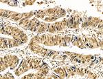 Phospho-Cyclin E (Thr73) Antibody in Immunohistochemistry (Paraffin) (IHC (P))