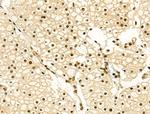 Phospho-Cyclin E (Thr73) Antibody in Immunohistochemistry (Paraffin) (IHC (P))