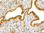 Phospho-Cyclin E (Thr73) Antibody in Immunohistochemistry (Paraffin) (IHC (P))