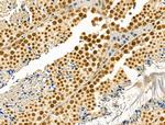 Phospho-Cyclin E (Thr73) Antibody in Immunohistochemistry (Paraffin) (IHC (P))