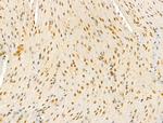 Phospho-Cyclin E (Thr73) Antibody in Immunohistochemistry (Paraffin) (IHC (P))