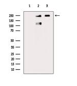 Phospho-CAD (Ser1859) Antibody in Western Blot (WB)