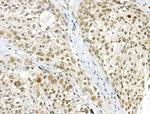 Phospho-cdc25C (Ser198) Polyclonal Antibody