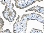 Phospho-cdc25C (Ser198) Antibody in Immunohistochemistry (Paraffin) (IHC (P))