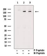 Phospho-IRS1 (Ser323) Polyclonal Antibody
