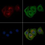 Phospho-FLT3 (Tyr842) Polyclonal Antibody