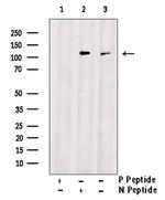 Phospho-FLT3 (Tyr842) Antibody in Western Blot (WB)