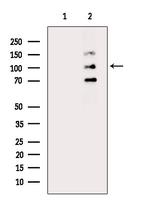Phospho-SREBP1 (Ser396) Polyclonal Antibody