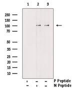 Phospho-GluR1 (Ser849) Polyclonal Antibody