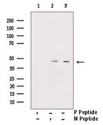 Phospho-Rad52 (Tyr104) Polyclonal Antibody