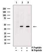 Phospho-Nkx2.1 (Ser327) Polyclonal Antibody