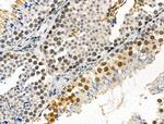 Phospho-IRAK1 (Thr100) Antibody in Immunohistochemistry (Paraffin) (IHC (P))