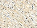 Phospho-IRAK1 (Thr209) Antibody in Immunohistochemistry (Paraffin) (IHC (P))