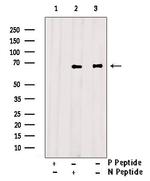 Phospho-ETK (Tyr40) Polyclonal Antibody