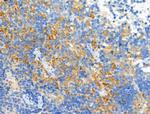 Phospho-PLCB3 (Ser537) Antibody in Immunohistochemistry (Paraffin) (IHC (P))