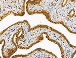 Phospho-PKC delta (Ser645) Polyclonal Antibody