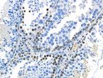 Phospho-MCL-1 (Ser64) Antibody in Immunohistochemistry (Paraffin) (IHC (P))