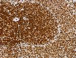 Phospho-MCL-1 (Ser64) Antibody in Immunohistochemistry (Paraffin) (IHC (P))
