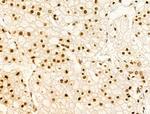 Phospho-FOXM1 (Ser35) Antibody in Immunohistochemistry (Paraffin) (IHC (P))