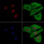 Phospho-53BP1 (Ser1618) Polyclonal Antibody