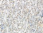 Phospho-53BP1 (Ser1618) Antibody in Immunohistochemistry (Paraffin) (IHC (P))